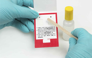 大便隱血（FOB）-免疫層析（膠體金、彩色乳膠及熒光免疫層析）解決方案