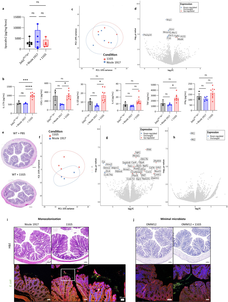 
大腸桿菌11G5感染不會增加Zeb2 IEC-Tg/+小鼠的結(jié)腸炎癥，也不會影響WT同窩小鼠的上皮細(xì)胞