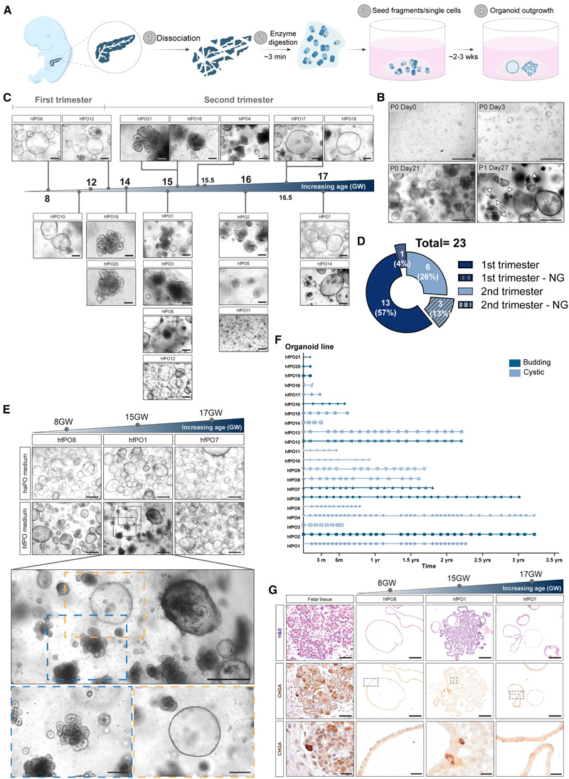 人胎兒胰腺類器官的建立