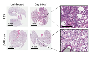 Nature Immunology：重新平衡免疫系統(tǒng)