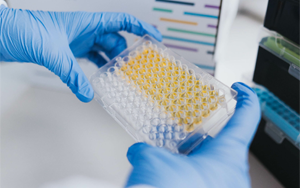 免疫技術(shù)新視界：層析、印跡、吸附與比濁的前沿碰撞