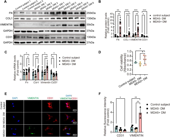 MDA5陽性皮肌炎患者血清可誘導(dǎo)原代小鼠肺微血管內(nèi)皮細(xì)胞發(fā)生內(nèi)皮-間質(zhì)轉(zhuǎn)化 MDA5陽性皮肌炎患者血清可誘導(dǎo)原代小鼠肺微血管內(nèi)皮細(xì)胞發(fā)生內(nèi)皮-間質(zhì)轉(zhuǎn)化