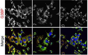 《Nature》細胞的應(yīng)激反應(yīng)比科學(xué)家認為的更細微、更分散