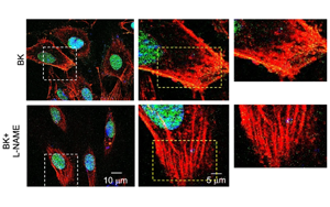 S-亞硝基化修飾 EZH2：調(diào)控內(nèi)皮穩(wěn)態(tài)的新機(jī)制與潛在治療靶點(diǎn)