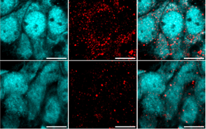 重大發(fā)現(xiàn)！阿爾茨海默病患者來(lái)源的高分子量 tau 蛋白如何 “破壞” 海馬神經(jīng)元？