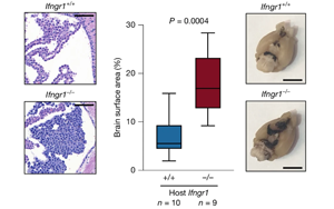 干擾素 -γ（IFNγ）調控軟腦膜抗腫瘤免疫應答的機制研究