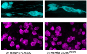 《Nature Neuroscience》大腦白質為何隨年齡退化？因為免疫細胞“勾心斗角”