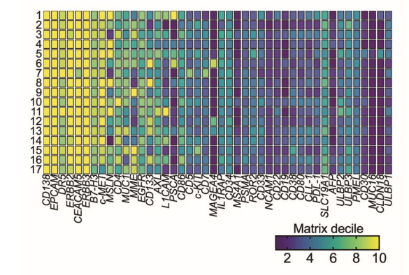 上皮細胞CAR抗原在結(jié)直腸癌肝轉(zhuǎn)移患者樣本中表達 上皮細胞CAR抗原在結(jié)直腸癌肝轉(zhuǎn)移患者樣本中表達
