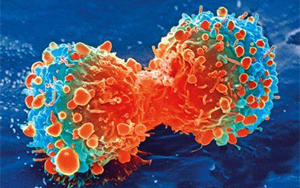 Nature Genetics：腫瘤轉(zhuǎn)移過程中會(huì)積累更多的拷貝數(shù)變異，而不是突變