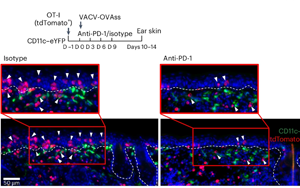 PD-1通過TGFβ信號通路調控皮膚組織駐留記憶T細胞（TRM）形成與功能分化的機制研究