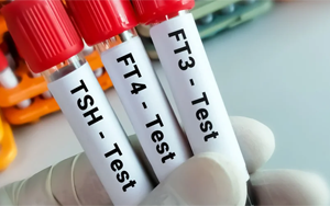 總及游離甲狀腺素（TT4及FT4）-磁微?；瘜W(xué)發(fā)光法（AE/AP）解決方案（雙抗體夾心法）