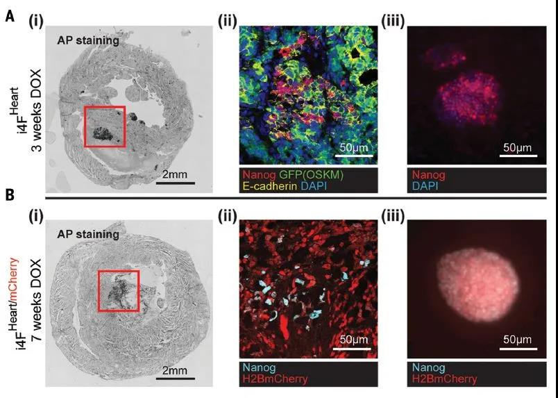 Science重磅：局部重編程讓心肌細(xì)胞“返老還童” 讓心臟實(shí)現(xiàn)再生！