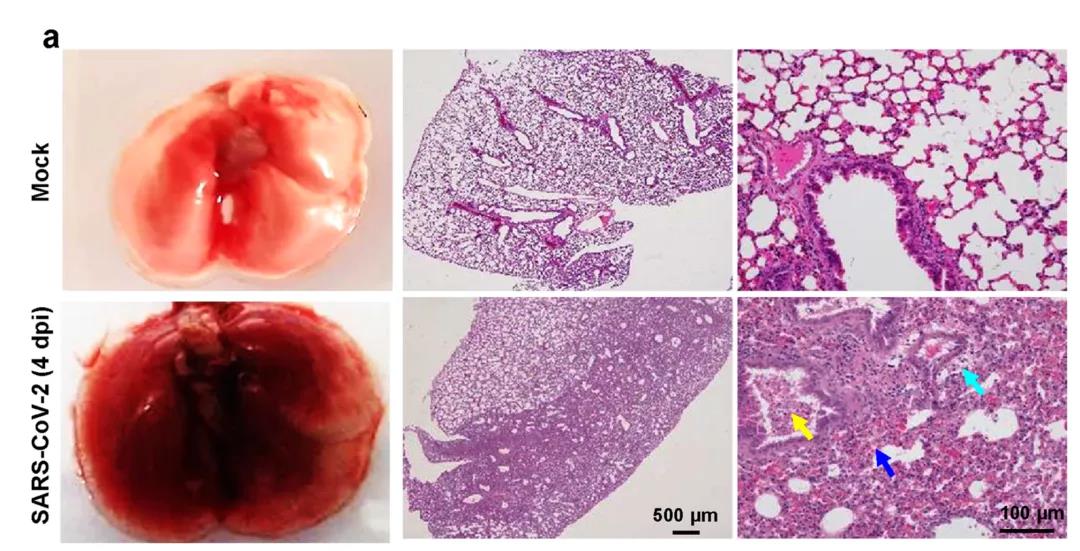 ?建模成功！Nature子刊：成功建立新冠肺炎重癥模型，揭示新冠病毒感染的分子機制