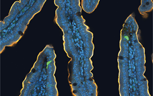 喝完無(wú)糖飲料還想吃甜食？人們對(duì)糖的渴望，無(wú)法被甜味劑替代，答案都在腸道里！