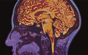 新冠帶來又一挑戰(zhàn)！下一步可能是“癡呆癥浪潮”