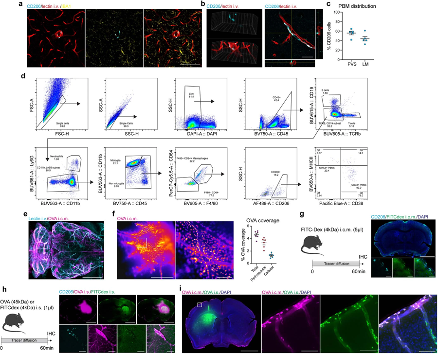 PBMs不同于小膠質(zhì)細胞和CSF和ISF樣本