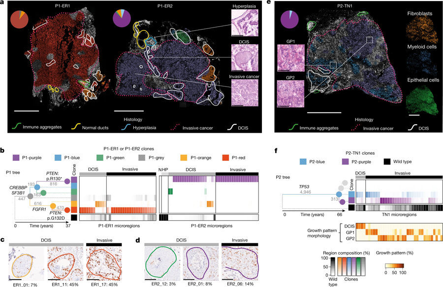 由三位原發(fā)性乳腺癌患者的組織學檢測繪制的遺傳克隆圖