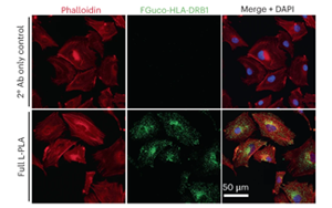 食用L-巖藻糖來對抗黑色素瘤