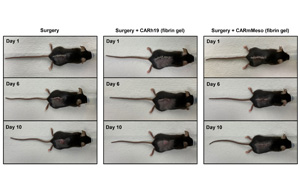 CAR-T細(xì)胞療法再獲突破！有效清除術(shù)后殘留癌細(xì)胞、預(yù)防腫瘤復(fù)發(fā)，即將開展臨床試驗