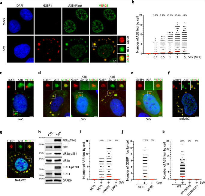 SeV感染誘導(dǎo)APOBEC3B定位于應(yīng)激顆粒 SeV感染誘導(dǎo)APOBEC3B定位于應(yīng)激顆粒