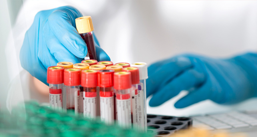 血氨檢測 血氨檢測