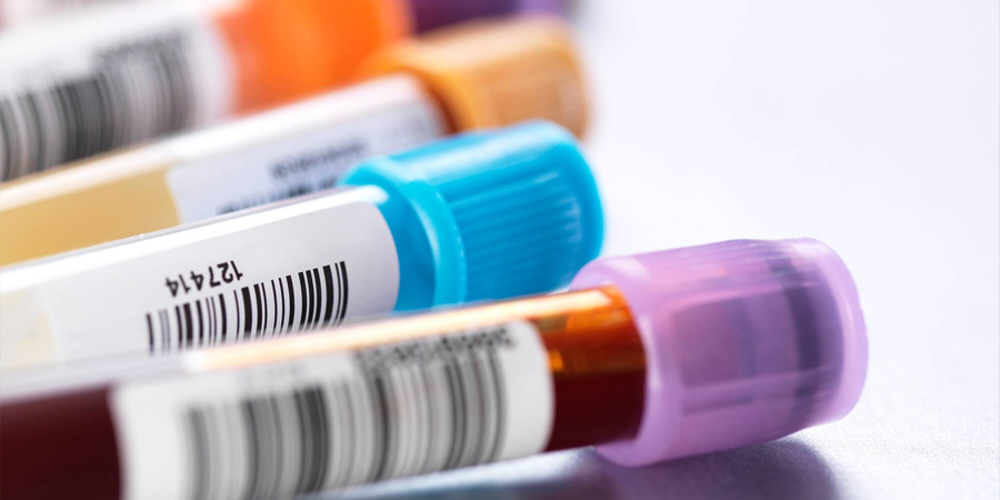 前蛋白檢測(cè)