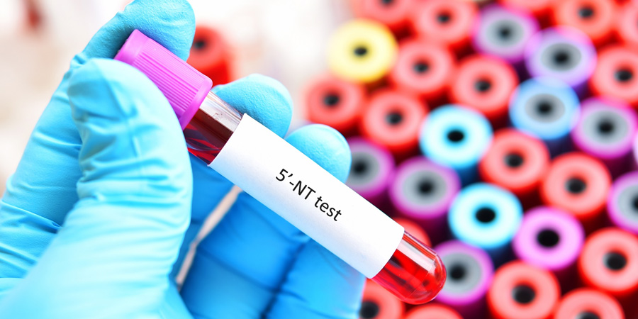 5'-核糖核苷酸磷酸水解酶檢測 5'-核糖核苷酸磷酸水解酶檢測