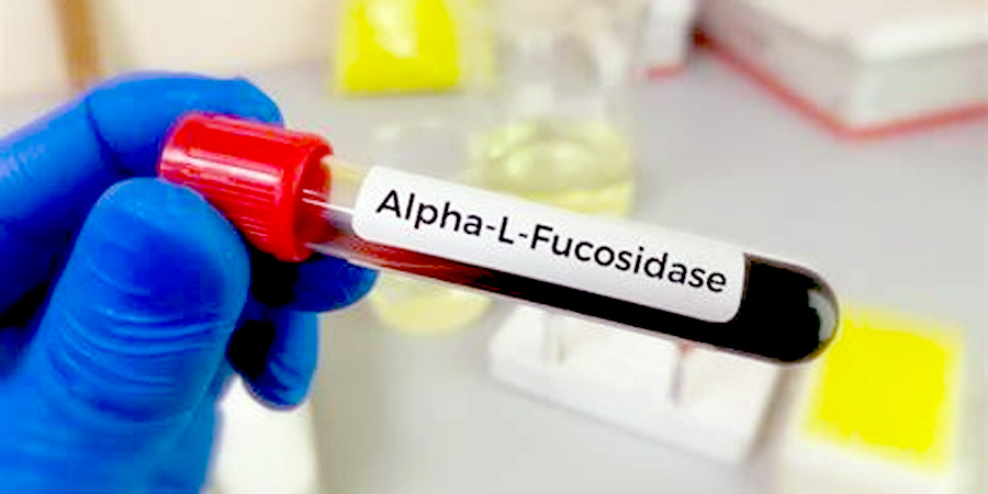 前蛋白檢測(cè)