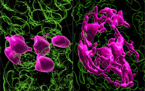 黑發(fā)原來是這樣變白的！Nature最新研究發(fā)現(xiàn)逆轉(zhuǎn)白發(fā)的關鍵所在