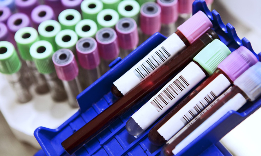 乳酸脫氫酶（LD/LDH）檢測