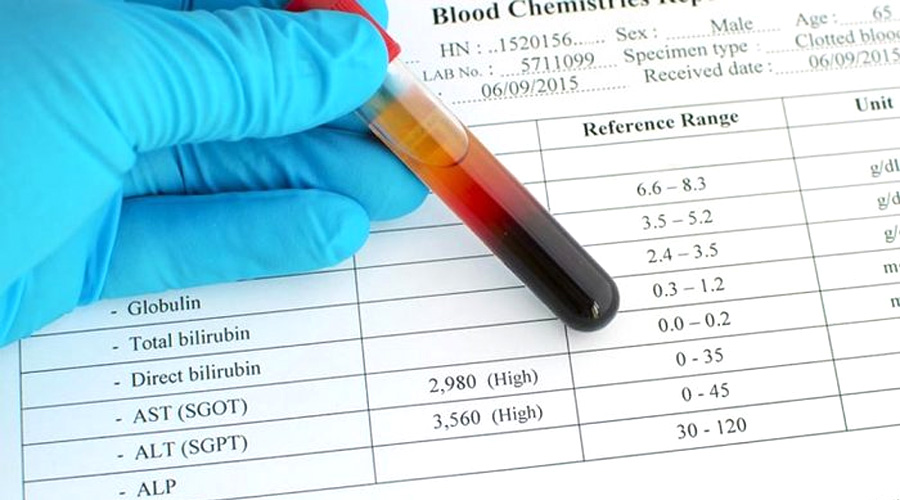 谷丙轉(zhuǎn)氨酶（ALT）檢測(cè)