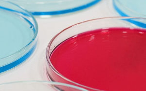 微生物檢測用培養(yǎng)基升級—顯色培養(yǎng)基