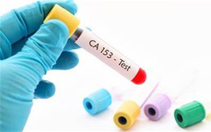 糖類(lèi)抗原15-3(CA15-3)-磁微粒化學(xué)發(fā)光法（AE/AP）解決方案