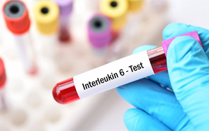 白介素-6（IL-6）-磁微?；瘜W(xué)發(fā)光（吖啶酯） /熒光免疫層析解決方案