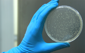 去除融合蛋白標(biāo)簽的選項(xiàng)TEV蛋白酶——看這里