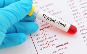 促甲狀腺素（TSH）-磁微?；瘜W(xué)發(fā)光法（吖啶酯） /熒光免疫層析解決方案