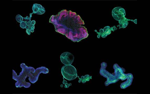 再生醫(yī)學的未來，到類器官的世界中去