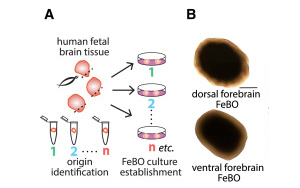 《Cell》新型組織衍生的大腦類器官可能會給大腦研究帶來革命性的變化