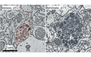 大腦什么時(shí)候長大?新發(fā)現(xiàn)震驚神經(jīng)科學(xué)家