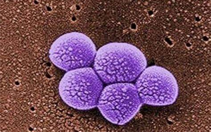 《Science》突破性新抗生素，遏制耐藥細(xì)菌