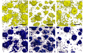 Nature：光和聲可以清除阿爾茨海默氏癥小鼠的淀粉樣蛋白！