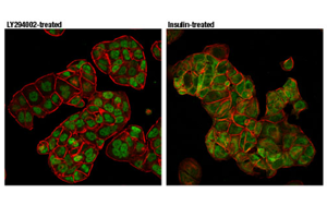 Nature最新發(fā)現(xiàn)控制CAR-T細(xì)胞壽命的蛋白質(zhì)！