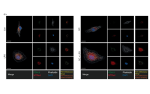 《Nature》第一次揭開(kāi)糖皮質(zhì)激素如何激活人體對(duì)炎癥的自然“剎車”