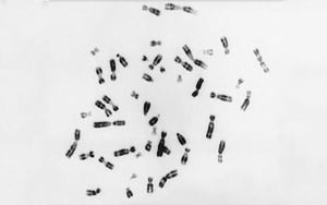 Nature：未知的補償機制——細(xì)胞如何處理額外的染色體