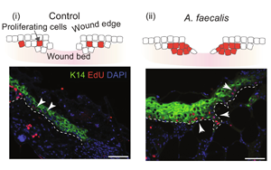 Science子刊揭示了一種細菌如何幫助慢性糖尿病傷口愈合